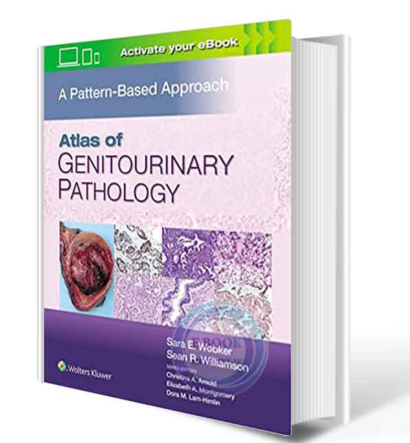 دانلود کتاب Atlas of Genitourinary Pathology: A Pattern Based Approach 2020(Epub+PDF)